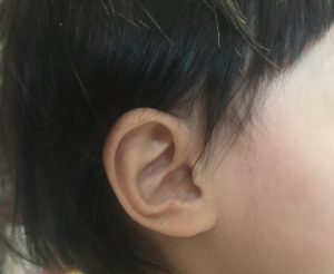 子供の耳